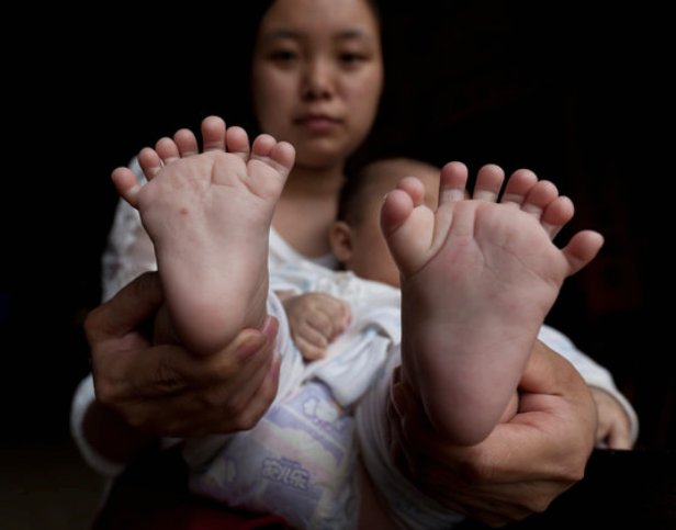 toes